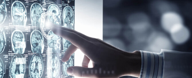 MRI scans