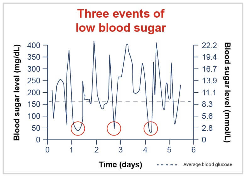Three events of low blood sugar